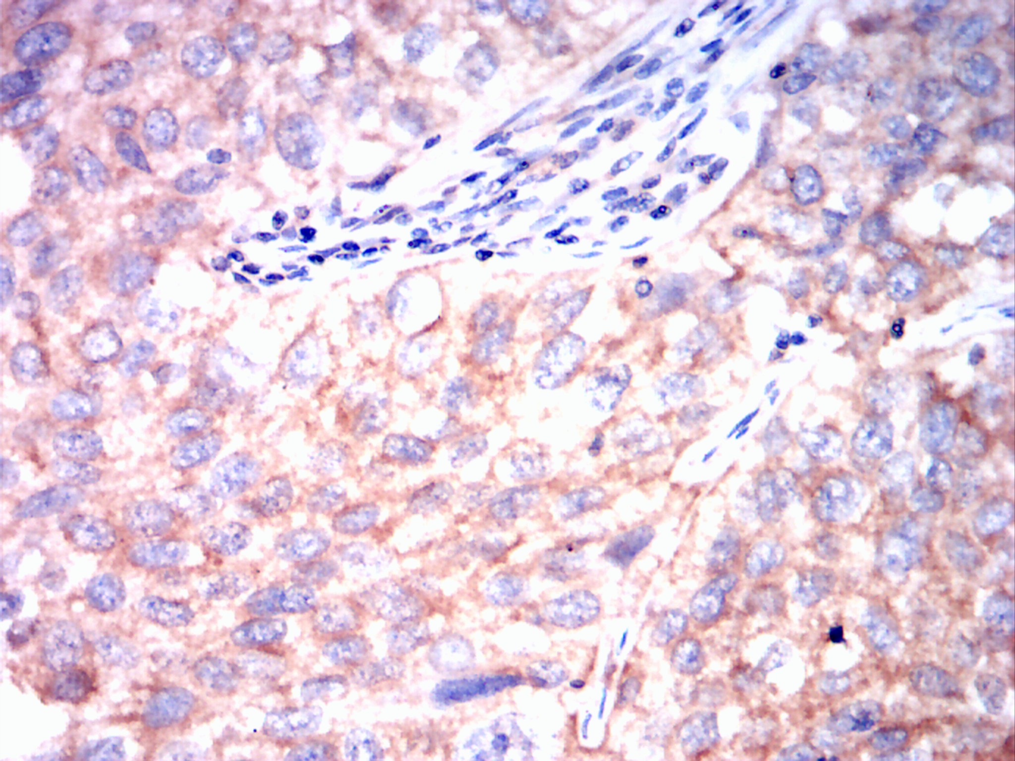                  IHC